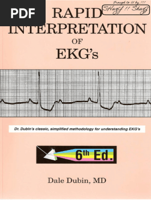 Rapid Interpretation of Ekg Sixth Edition PDF Xja Dr Notes