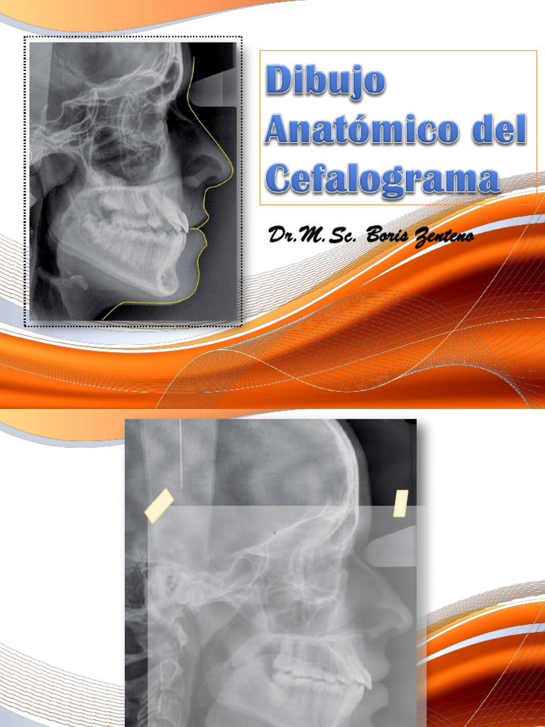 Dibujo Del Cefalograma PDF | PDF | Sistema musculoesquelético | Cabeza ...