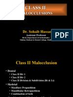 Class II Malocclusion