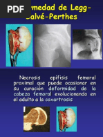 27.2 - patología de cadera II (perthes y epifisiolisis)