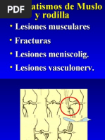 29 - Fracturas Muslo y Rodilla