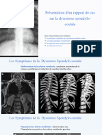 Dysosotose Spondylo-Costale