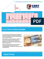 Electrocardiogram A