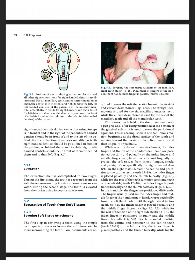 Dental Extraction Techniques | PDF | Tooth | Dentistry Branches