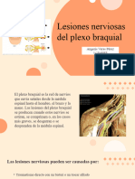 Lesiones Del Plexo Braquial