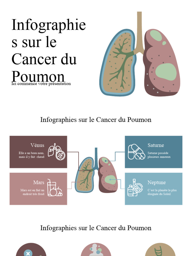 Infographies sur le Cancer du Poumon PDF Planètes Saturne — free download