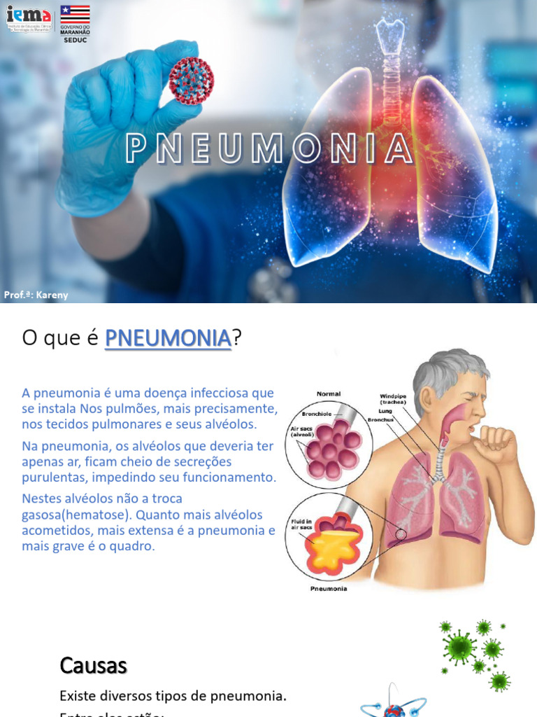 Apresentação pneumonia | PDF | Pneumonia | Medicina Clínica