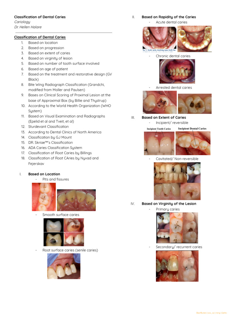 CARIOClassificationofDentalCaries PDF Tooth Enamel Tooth