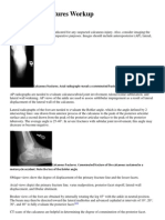 Calcaneus Fractures Workup: Imaging Studies