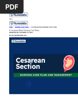 C-section