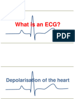 What Is An ECG?
