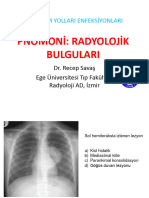 Pnömoni̇ Radyoloji̇k Bulgulari