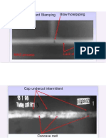 Cliché Radiographie