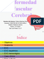 Enfermedad Vascular Cerebral