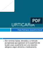 Urticaria: causas, síntomas y tratamiento