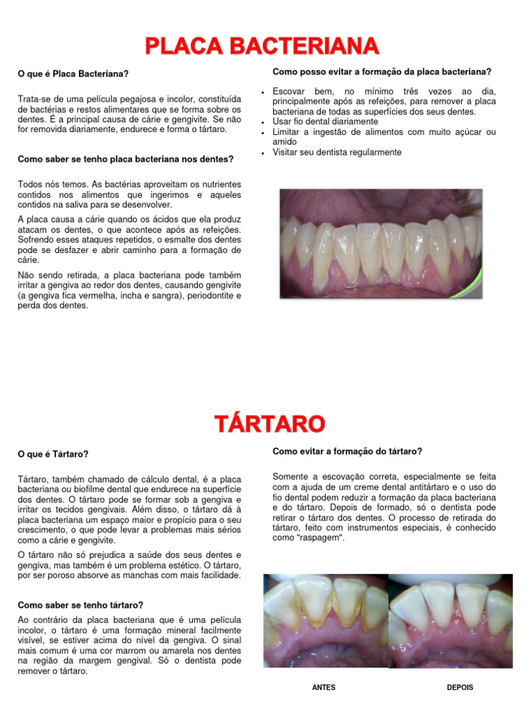 Album Seriado - Caroline Dousseau 2 | PDF | Dente | Doenças e distúrbios, image size:768x1024