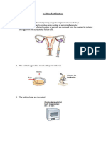 In Vitro Fertilization