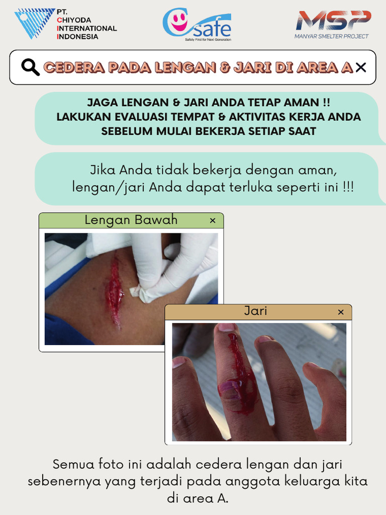 Finger Injuries Area A PDF