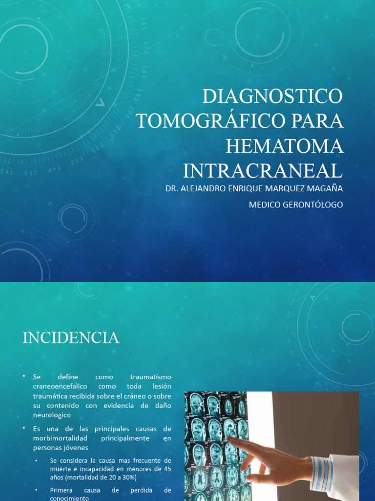 Diagnostico radiológico para hematoma intracraneal PDF