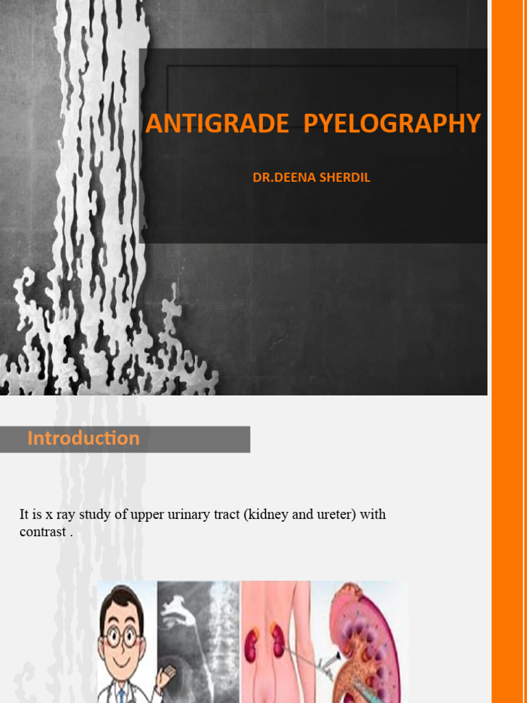 Antigrade Pyelography Procedure Guide | PDF | Science & Mathematics