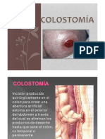Colostomia e Ileostomia