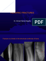 Pediatric Fractures