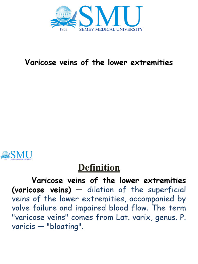 Презентация англ | PDF | Vein | Varicose Veins
