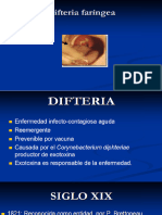 Difteria