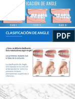 Maloclusines de Angle Anatomía 2023