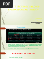 Endovascular Therapy Neuro Intervention (MT) in AIS DR Ganesh