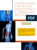 Alteraciones Musculo-Esqueleticas y Displasia de Cadera