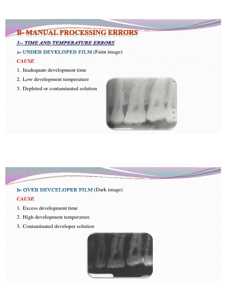 Film Development Issues and Causes | PDF