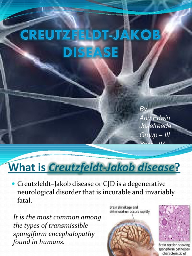Creutzfeldtjakob Disease 1 Health Sciences Wellness
