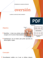 Cardioversión