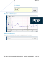 Cara Ecg