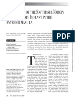 R S M S I A M: Estoration of The Oft-Tissue Argin IN Ingle-Tooth Mplant in The Nterior Axilla