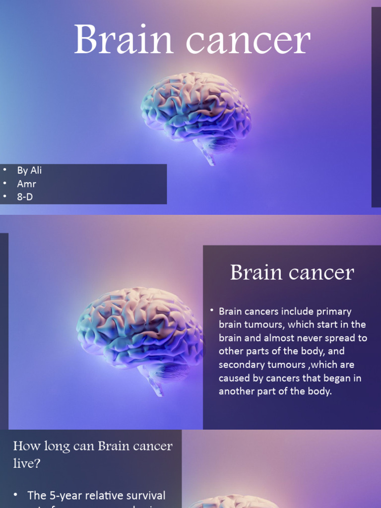 Brain cancer pdf