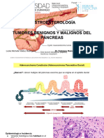 Gatroenterología, Tumores Benignos y Malignos Del Páncreas, Leslie Valdez 7B
