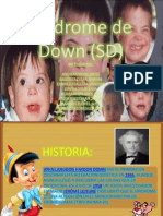 Síndrome de Down (SD)