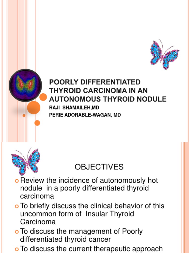Poorly Differentiated Thyroid Carcinoma | PDF | Thyroid | Cancer