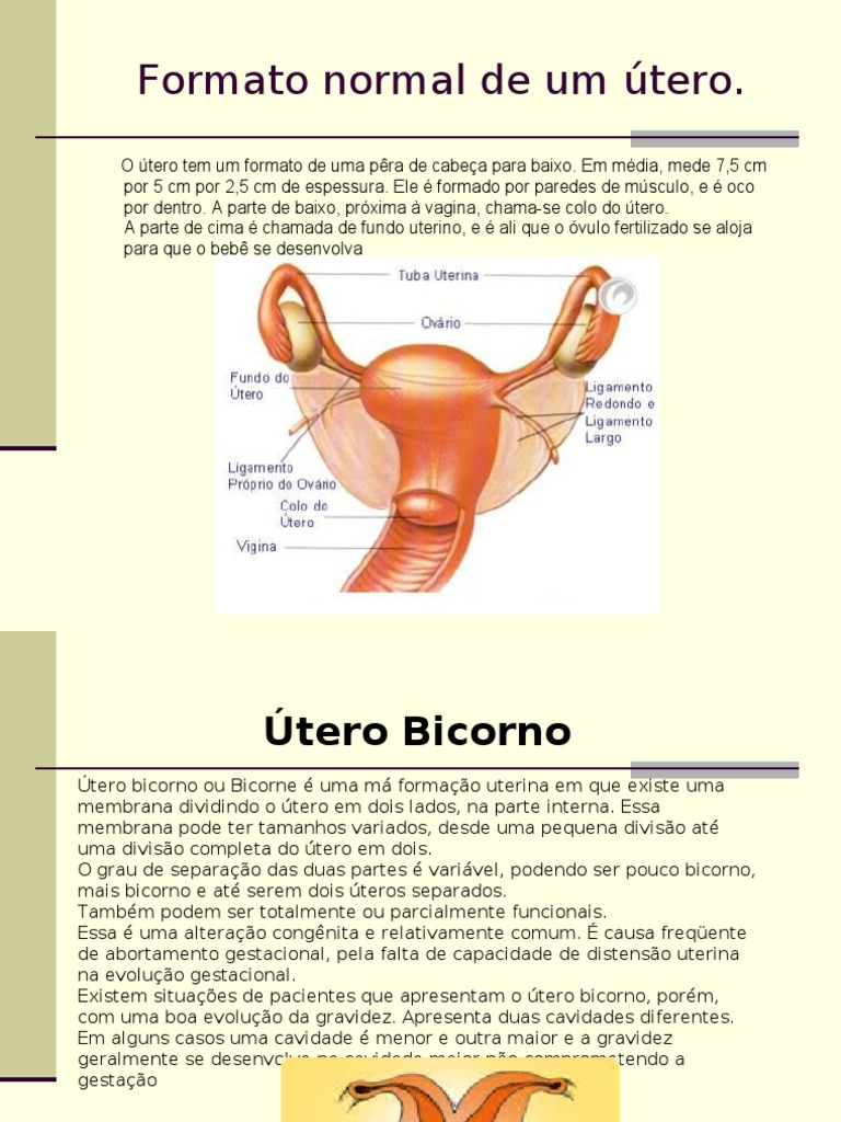 Útero Bicorno. | Gravidez | Reprodução Humana