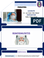 RINOSINUSITIS