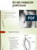 Urgencias de Oido