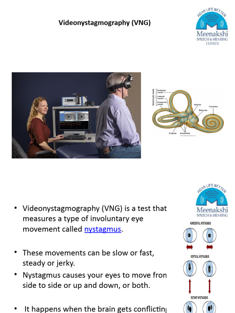 Videonystagmography (VNG) | PDF
