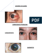 Lesiones Oculares