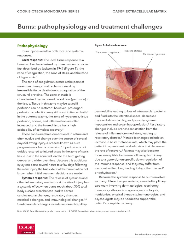 Burn Pathophysiology | PDF | Burn | Inflammation