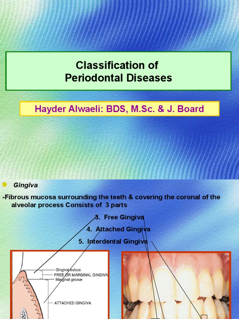 CLASSIFICATION OF PERIODONTAL DISEASES 3rd year Periodontology Mouth