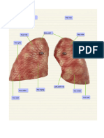 GP Hô Hấp Dưới