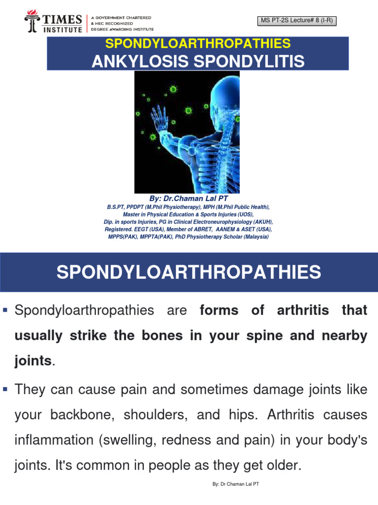 Understanding Ankylosing Spondylitis | PDF