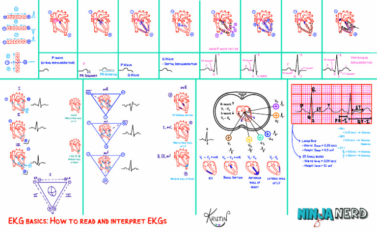 ECG Basics - Ninjanerd | PDF